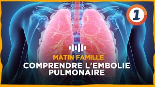 Comprendre lembolie pulmonaire [upl. by Korman]