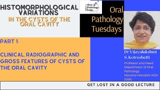 Variations in Cysts of the Oral Cavity part 1 Oral Pathology 360 Fundamantals [upl. by Eedyak865]