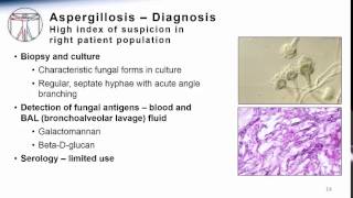 Aspergillosis [upl. by Ikoek666]