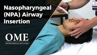 Nasopharyngeal Airway NPA Insertion [upl. by Tova]