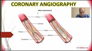 CORONARY ANGIOGRAPHY 101 NIK NIKAM MD [upl. by Nyrok]