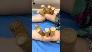 Cupping therapy restores health food relax cuppingtherapy massage satisfying [upl. by Marie-Jeanne526]