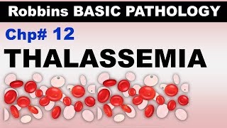 Ch12  Thalassemias  αThalassemia  βThalassemia  Blood Pathology  Dr Asif Lectures [upl. by Ellehcsar]