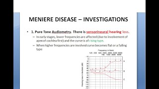 ENT Menieres Disease Part 2 Examination Investigations Diagnosis Staging Ear Check test confirm [upl. by Slrahc662]