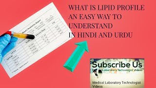 Cholesterol LDL HDL amp Lipid Profile Facts in hindi and urdu [upl. by Cyprus]