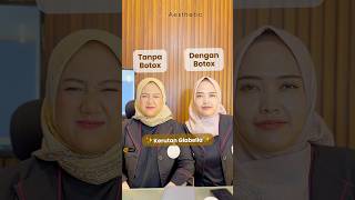 Botox Treatment at Fabella skincare klinikkecantikan [upl. by Aihseket]