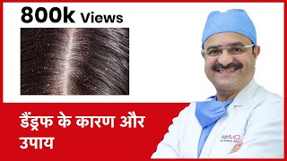 How To Get Rid Of Dandruff  डैंड्रफ के कारण और उपाय  HairMD Pune  In HINDI [upl. by Zollie]