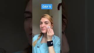 Icing Face Before and After 7Day Ice Cube Challenge Results [upl. by Amahs]