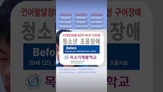 발음연습 조음치료 조음장애 dysarthria 혀운동 혀스트레칭 불수의적 혀근육 마비성 구어장애 Tongue paralysis muscle 혀마비 842 목소리재활학교 [upl. by Lulita]