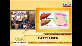 Facts about Fatty Liver  Usapang Pangkalusugan [upl. by Levison700]