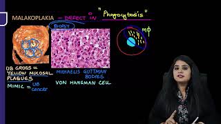 Renal Pathology Rapid Revision For FMGE amp NEET PG By Dr Preeti Sharma [upl. by Bergerac]