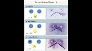 BScimmunology practicalouchterlonys double immunodiffusion methodprecipitation pattern [upl. by Anstice]