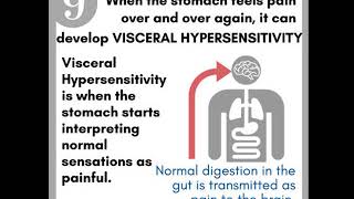 Why Does Clinical Hypnosis Help IBS  4 Visceral Hypersensitivity [upl. by Adnahc737]