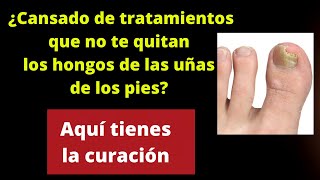 ¿Cansado de tratamientos que no te quitan los hongos de las uñas Aquí tienes la curación [upl. by Pylle]