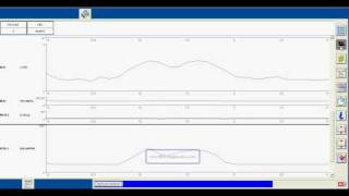 Ford IDS particle filter DPF regeneration and datastream recording [upl. by Endaira]