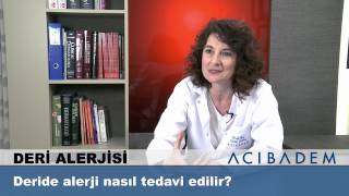 Deride alerji nasıl tedavi edilir [upl. by Floridia]