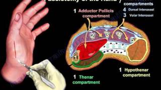 Compartment Syndrome Of The Hand amp Finger  Everything You Need To Know  Dr Nabil Ebraheim [upl. by Elbag452]