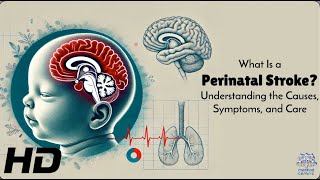 Perinatal Stroke Explained What Every Parent Needs to Know [upl. by Diver]