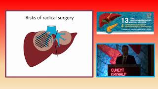 Cüneyt Kayaalp  Management of biliary complications of hydatid disease [upl. by Anitsahs633]