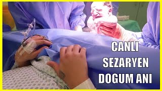 CANLI SEZARYEN DOGUM YAPTIM YENIDOGAN BEBEK SURPRIZ CINSIYET [upl. by Ernesta]