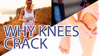 Knee cracking explained  Warning sign or normal phenomenon [upl. by Tierney826]