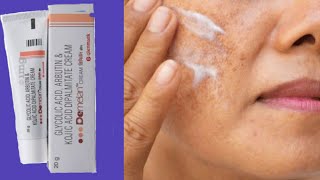 Demelan cream complete Information  Remove Pigmentation Acne scars Pimple marks [upl. by Neidhardt]