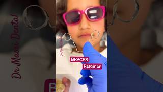 Braces  ORTHODONTICS Retainers [upl. by Vocaay663]