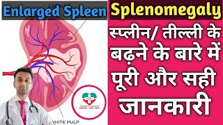 Splenomegaly। Speen प्लीहा तील्ली के बारे में पूरी जानकारी। CausesTypesTreatment Of Splenomgaly [upl. by Baskett]