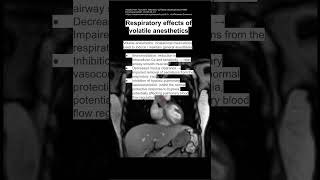 Respiratory effects of volatile anesthetics [upl. by Chemash]