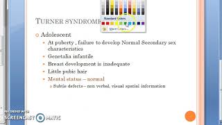 Pathology 253 a Genetics Turner Syndrome [upl. by Zebapda]