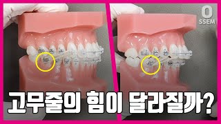 치아교정 고무줄 교합 상태별 고무줄 걸기2급부정교합3급부정교합어금니교합 맞춤 1부 [upl. by Seuqcaj205]