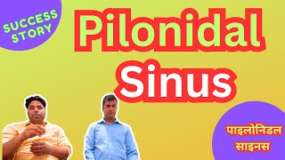 Permanent cure for Pilonidal sinus  success story  Patient feedback [upl. by Grubb]