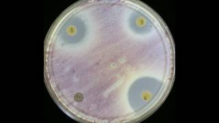 Chromobacterium Isolation on white rice [upl. by Arin]