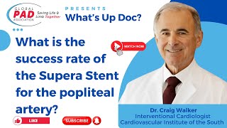 Supera Stent For Popliteal Artery Blockage Behind Knee [upl. by Booma221]