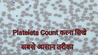 Platelet count under microscope  Platelets Count करना सिखे [upl. by Madelaine]