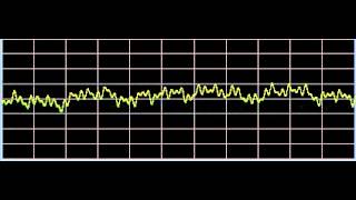 Vitiligo  Rife Frequencies [upl. by Nnylrac]