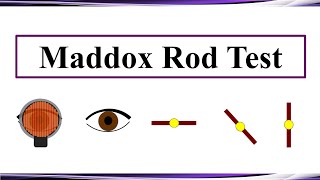 Maddox Rod Test [upl. by Hobie836]