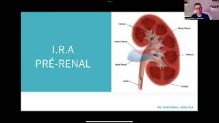 1 injuria renal aguda [upl. by Arikahc32]