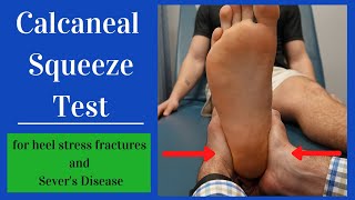 Calcaneal Squeeze Test Heel Squeeze [upl. by Raab11]