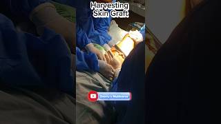 Harvesting skin graft Open wound Management  medical surgicalskills plasticsurgery [upl. by Leummas810]