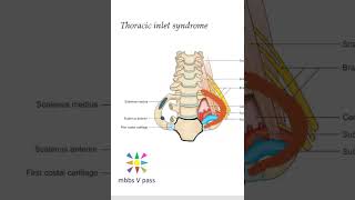 Anatomy Thorax 214 Thoracic inlet syndrome viva [upl. by Arthur498]