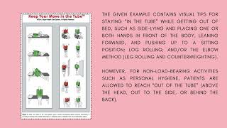 What are the sternal precautions post Coronary Artery Bypass Grafting [upl. by Notsahc]