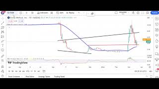 USA Chartbreakers March 20 [upl. by Macguiness]