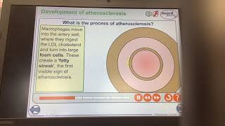 KS4GCSEBIOLOGYOrganisationThe process of atherosclerosis [upl. by Gresham]