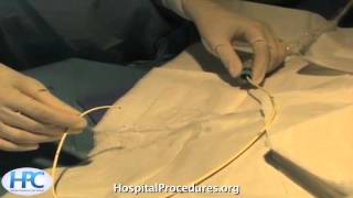 Pulmonary Artery Catheter Video [upl. by Ytisahc310]