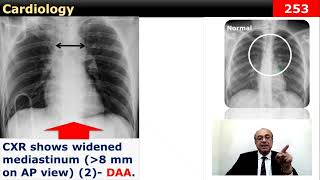 internalmedicine cme usmle محاضراتباطنة ecg كورساتباطنة clinical clinical medicine [upl. by Ynatirb]