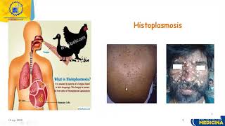 Microbiología para medicina Micosis profundas Histoplasmosis y criptococosis [upl. by Aymer45]