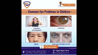 Common eye problems in children include astigmatism strabismus myopia hyperopia lazy eye amblyo [upl. by Ainitsirk]