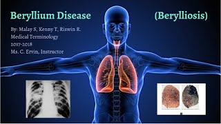 Beryllium Disease Symptoms and Causes  Diagnosis  Treatment  Prevention [upl. by Eenej829]