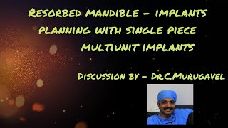 Resorbed mandible  implants planning with single piece multiunit implants [upl. by Acnayb703]